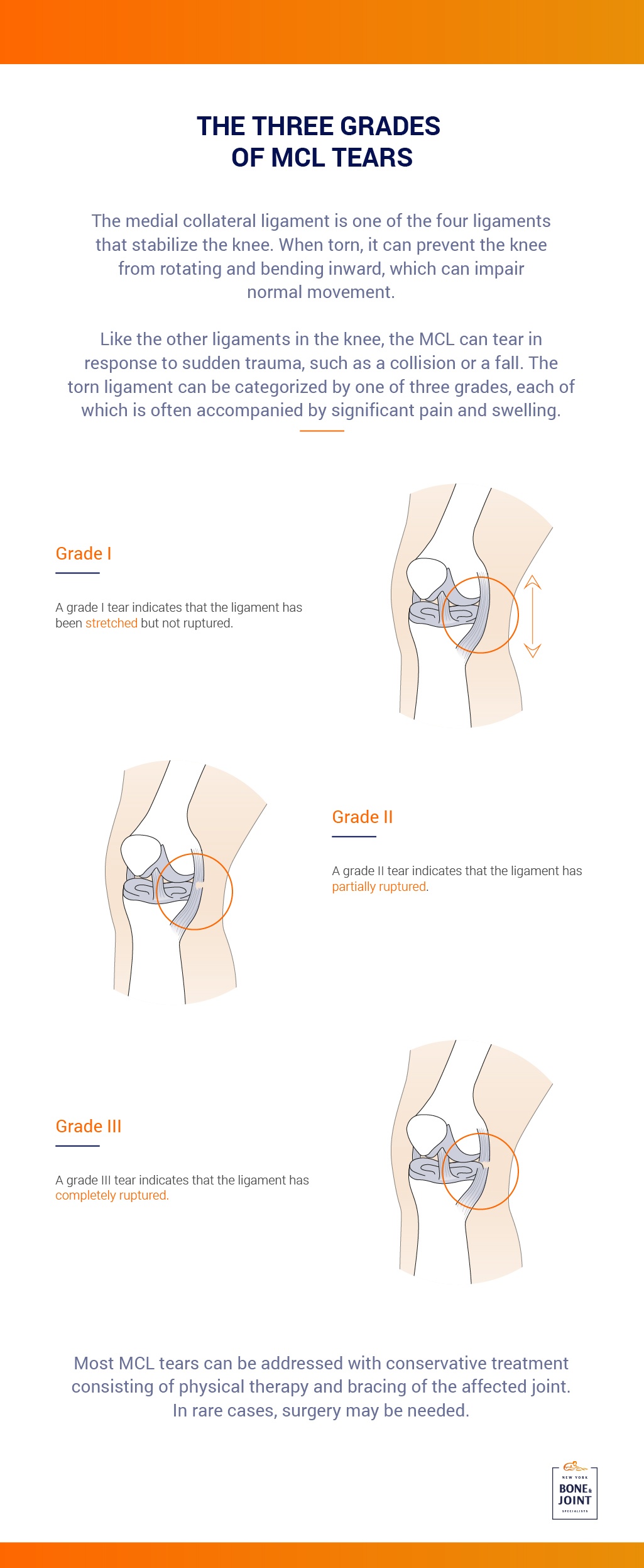 How to diagnose and treat a medial collateral ligament and lateral
