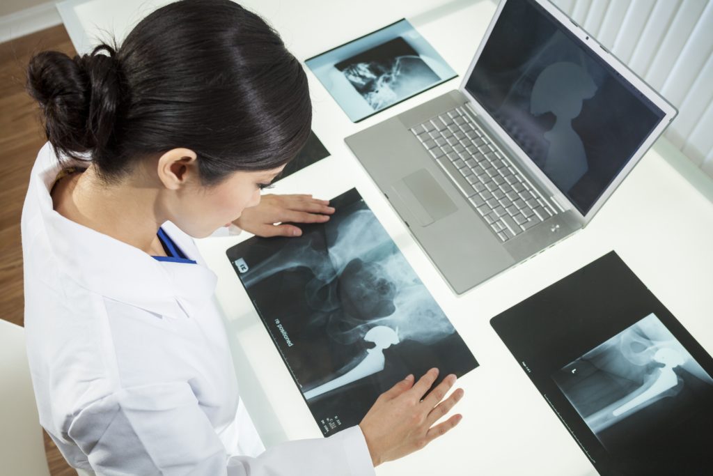 hip replacement surgery